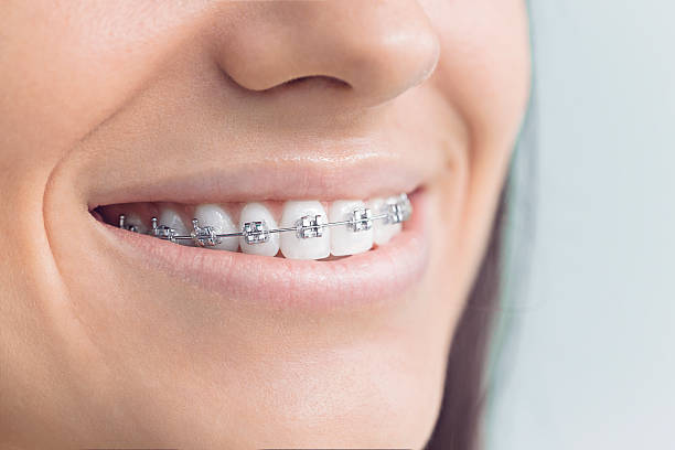Best Veneers and Lumineers  in Fillmore, UT